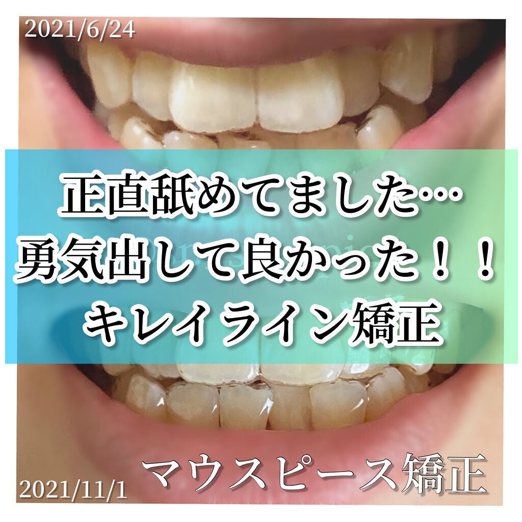 オーラツーミー アロマフレーバーコレクション ペースト/オーラツー/歯磨き粉を使ったクチコミ(1枚目)