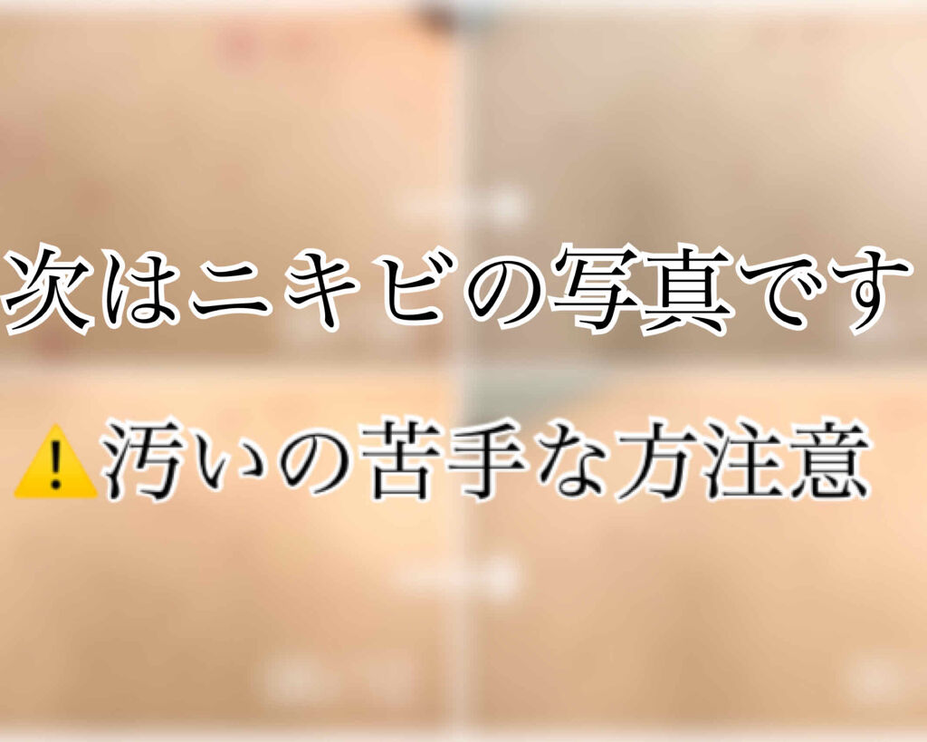 セナキュア(医薬品)/小林製薬/その他を使ったクチコミ（2枚目）