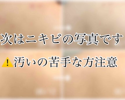セナキュア(医薬品)/小林製薬/その他を使ったクチコミ(2枚目)