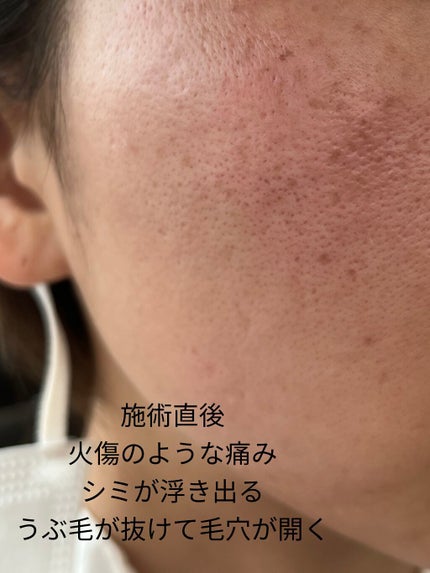 を使ったクチコミ(2枚目)