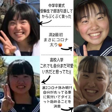 かっさプレート Daisoの口コミ 初めまして こんぶです こぶたから人間 By こんぶ 乾燥肌 10代後半 Lips かっさプレート Daisoの口コミ 初めまして こんぶです こぶたから人間 By こんぶ 乾燥肌 10代後半 Lips