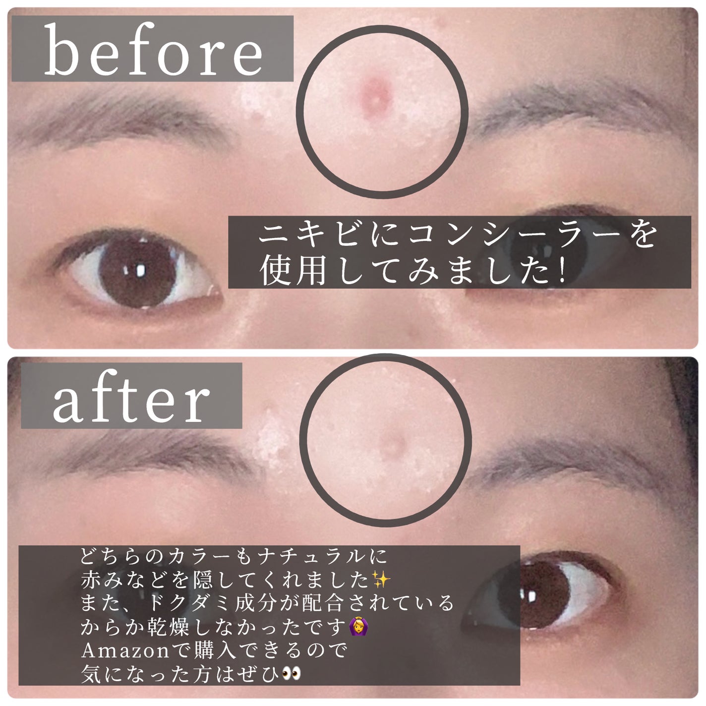 ダーマシンコンシーラー/23years old/リキッドコンシーラーを使ったクチコミ(4枚目)