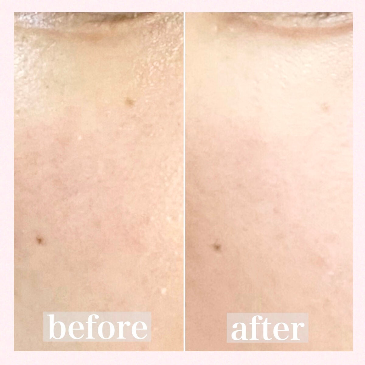 マシュマロフィニッシュパウダー ~Abloom~/キャンメイク/プレストパウダーを使ったクチコミ(5枚目)