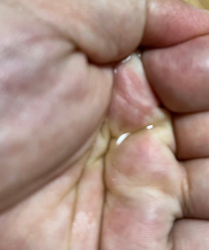 センテラ ライトクレンジングオイル/SKIN1004/オイルクレンジングを使ったクチコミ(1枚目)