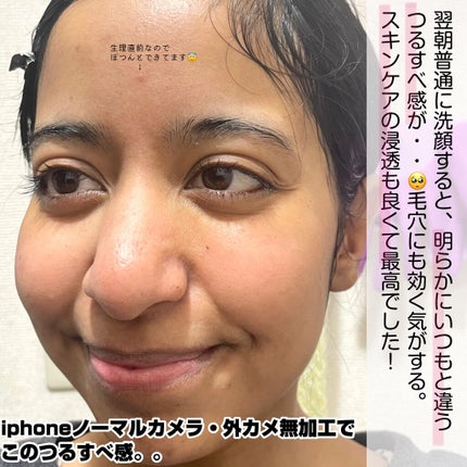 BHA ピーリングアンプル/beplain/美容液を使ったクチコミ(6枚目)