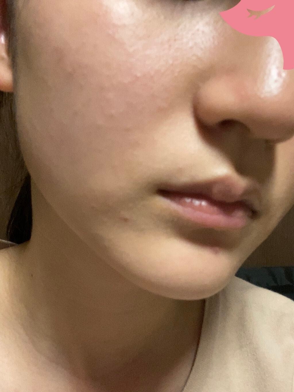 薬用美白美容液/なめらか本舗/美容液を使ったクチコミ(2枚目)