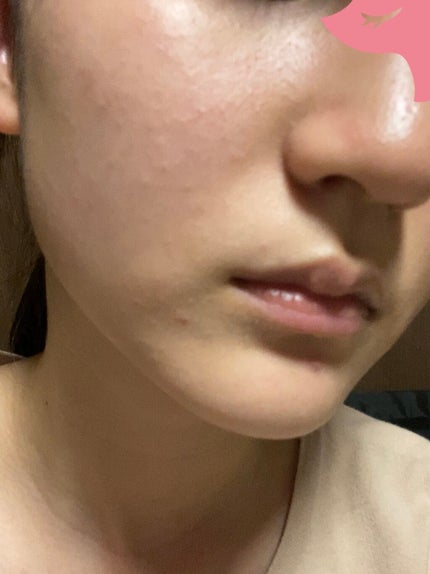 薬用美白美容液/なめらか本舗/美容液を使ったクチコミ(2枚目)