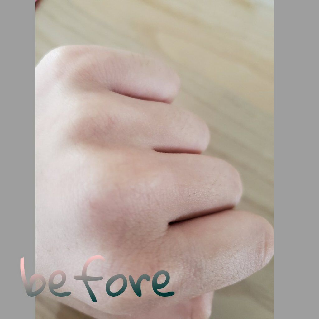 除毛クリームキット敏感肌用/エピラット/除毛クリームを使ったクチコミ(2枚目)