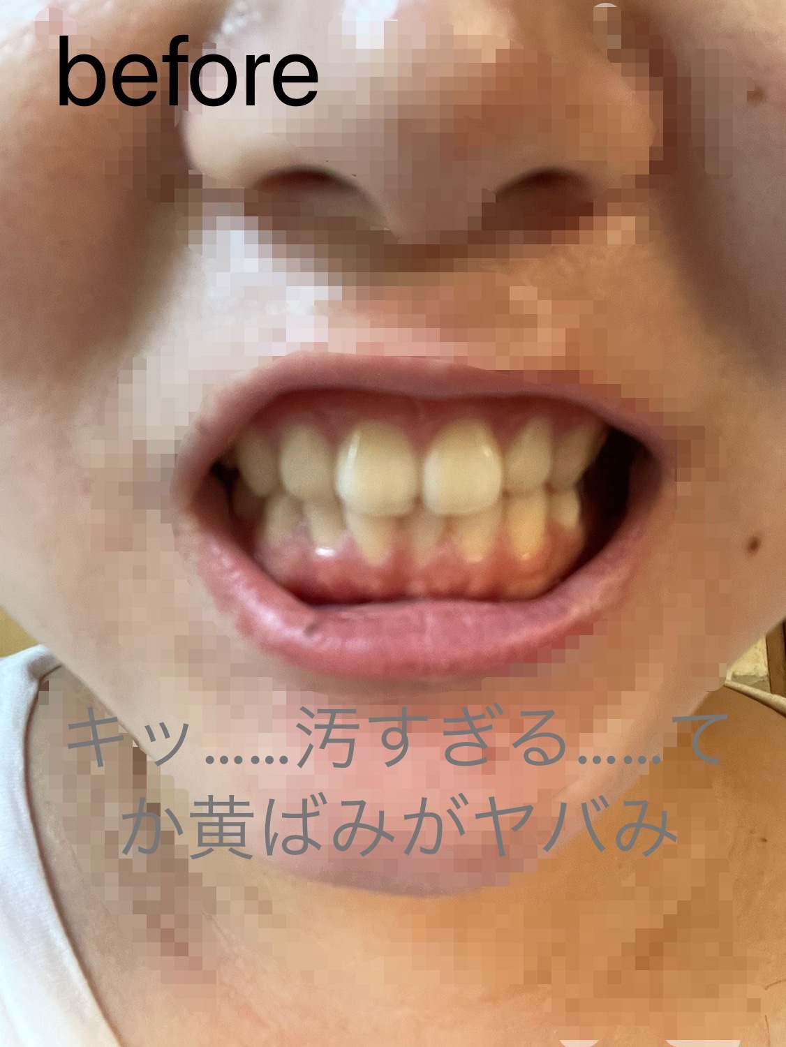 歯磨き堂 薬用ホワイトニングペースト プレミアム/歯磨き堂/歯磨き粉を使ったクチコミ（2枚目）