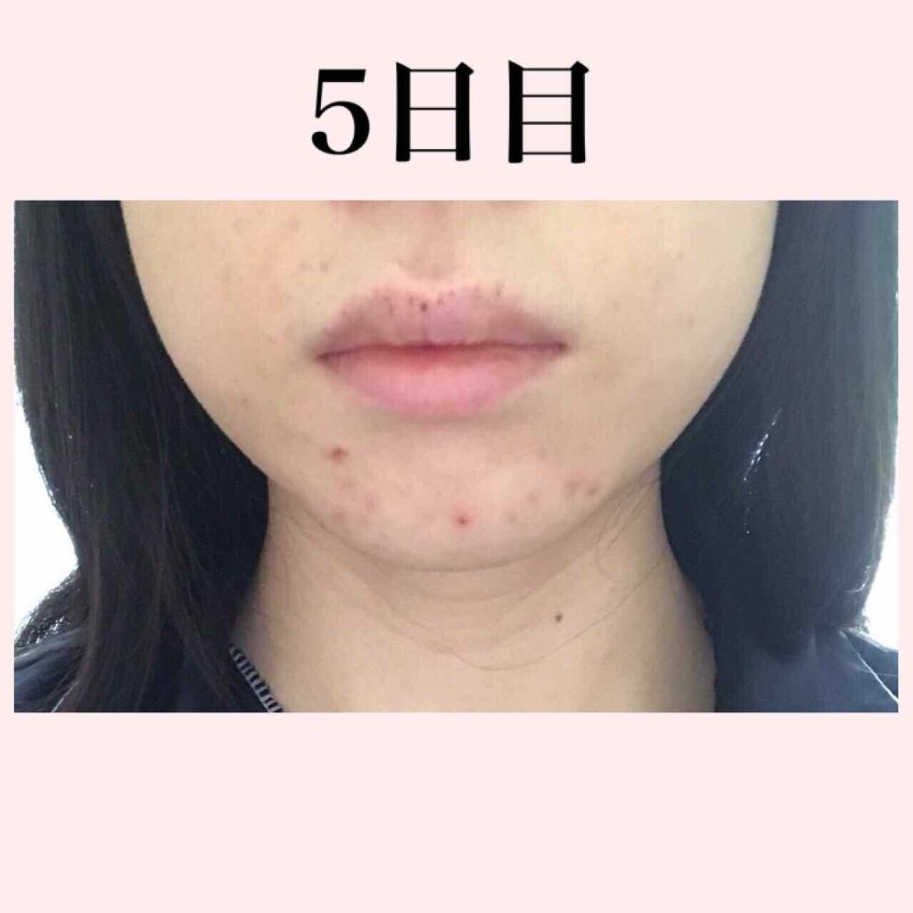 ファイバーフォーム/ルナメアAC/洗顔フォームを使ったクチコミ(2枚目)