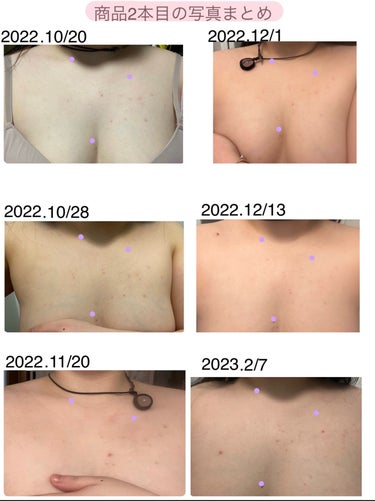 セナキュア(医薬品)/小林製薬/その他を使ったクチコミ（3枚目）