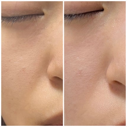 レチノール スーパーバウンス セラム/IOPE/美容液を使ったクチコミ(4枚目)