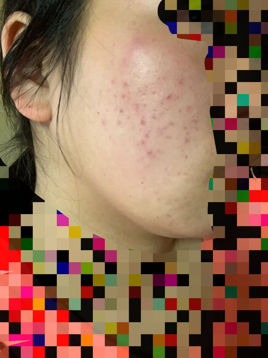 ヘルプミー! ダクトパッド/One-day's you/トナーパッドを使ったクチコミ（3枚目）