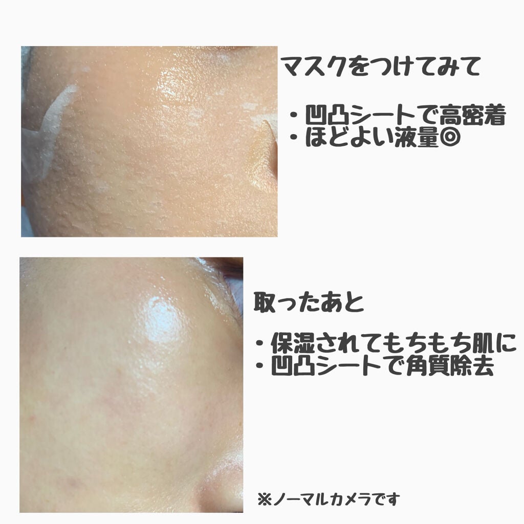 ããããBOMBãã¹ã¯/ã¯ãªã¢ã¿ãŒã³/ã·ãŒããã¹ã¯ã»ããã¯ã䜿ã£ãã¯ãã³ãïŒ3æç®ïŒ