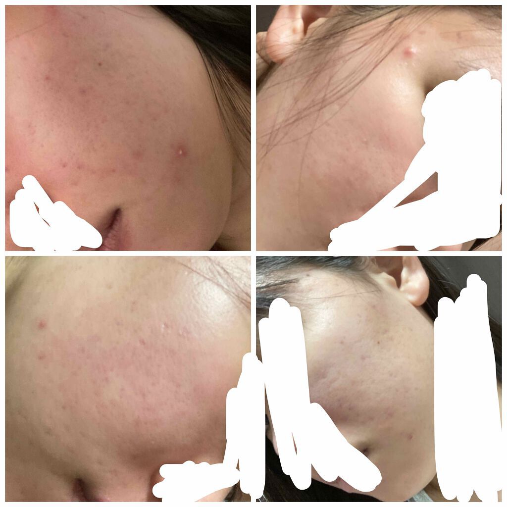 ミノン アミノモイスト モイストチャージ ローションI しっとりタイプ/ミノン/化粧水を使ったクチコミ（3枚目）