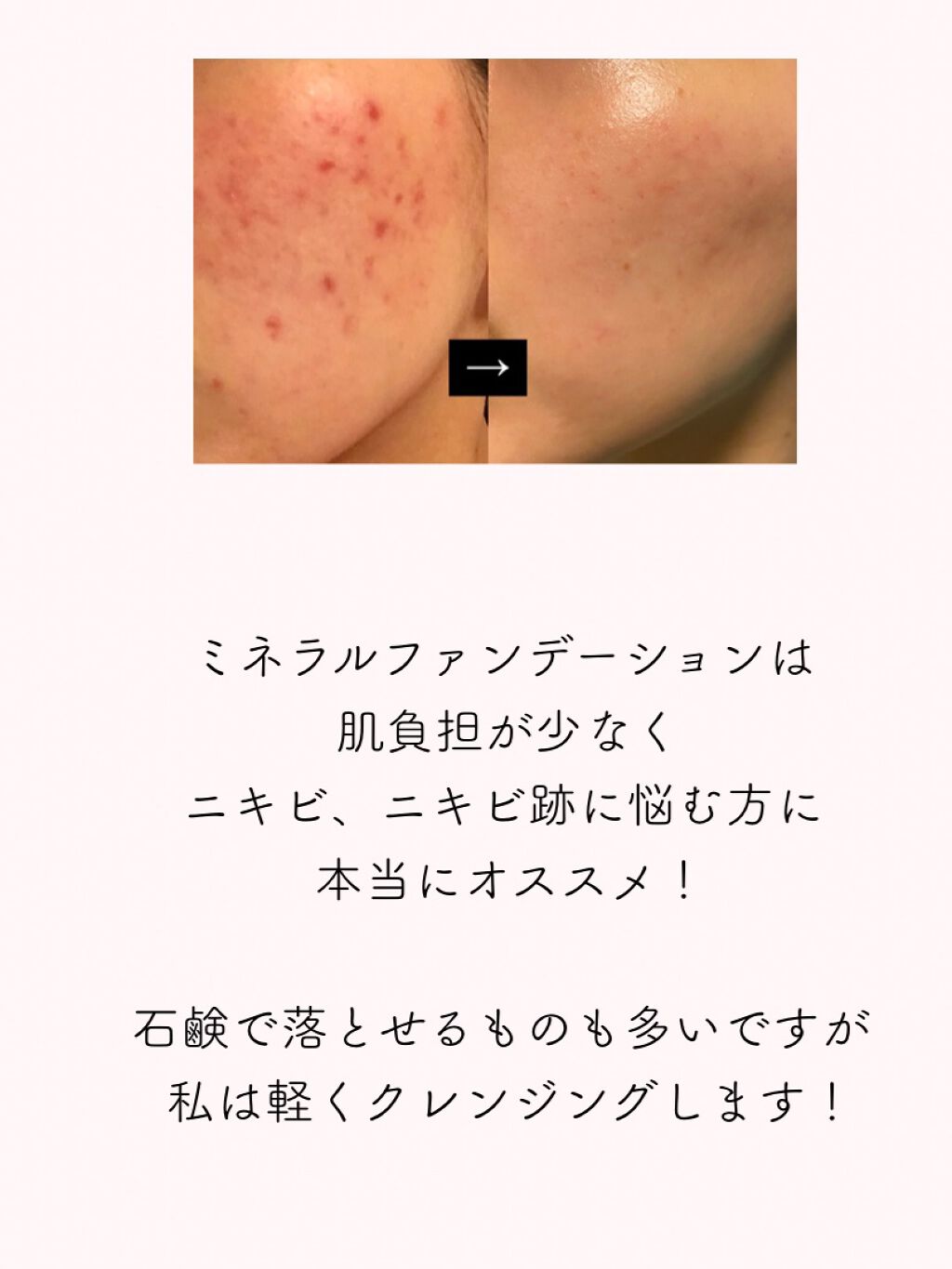 ミネラルシルクファンデーション（ケース・パフ付）/ヴァントルテ/パウダーファンデーションを使ったクチコミ（3枚目）