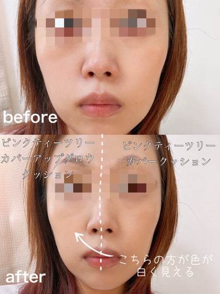 ピンクティーツリーカバークッション/APLIN/クッションファンデーションを使ったクチコミ(4枚目)