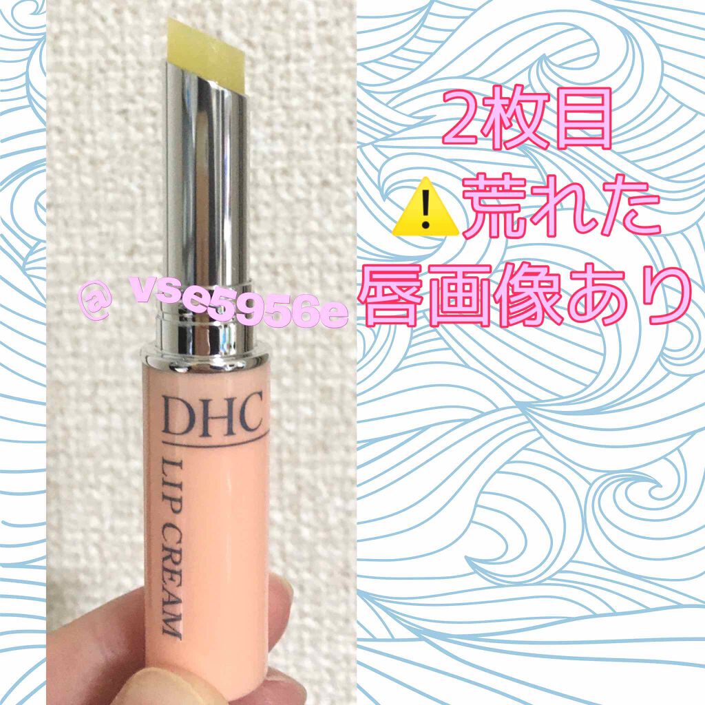 薬用リップクリーム Dhcの辛口レビュー シンプルに塗ってみた感想を簡潔に By アバンドバン E 乾燥肌 代後半 Lips 薬用リップクリーム Dhcの辛口レビュー シンプルに塗ってみた感想を簡潔に By アバンドバン E 乾燥肌 代後半 Lips