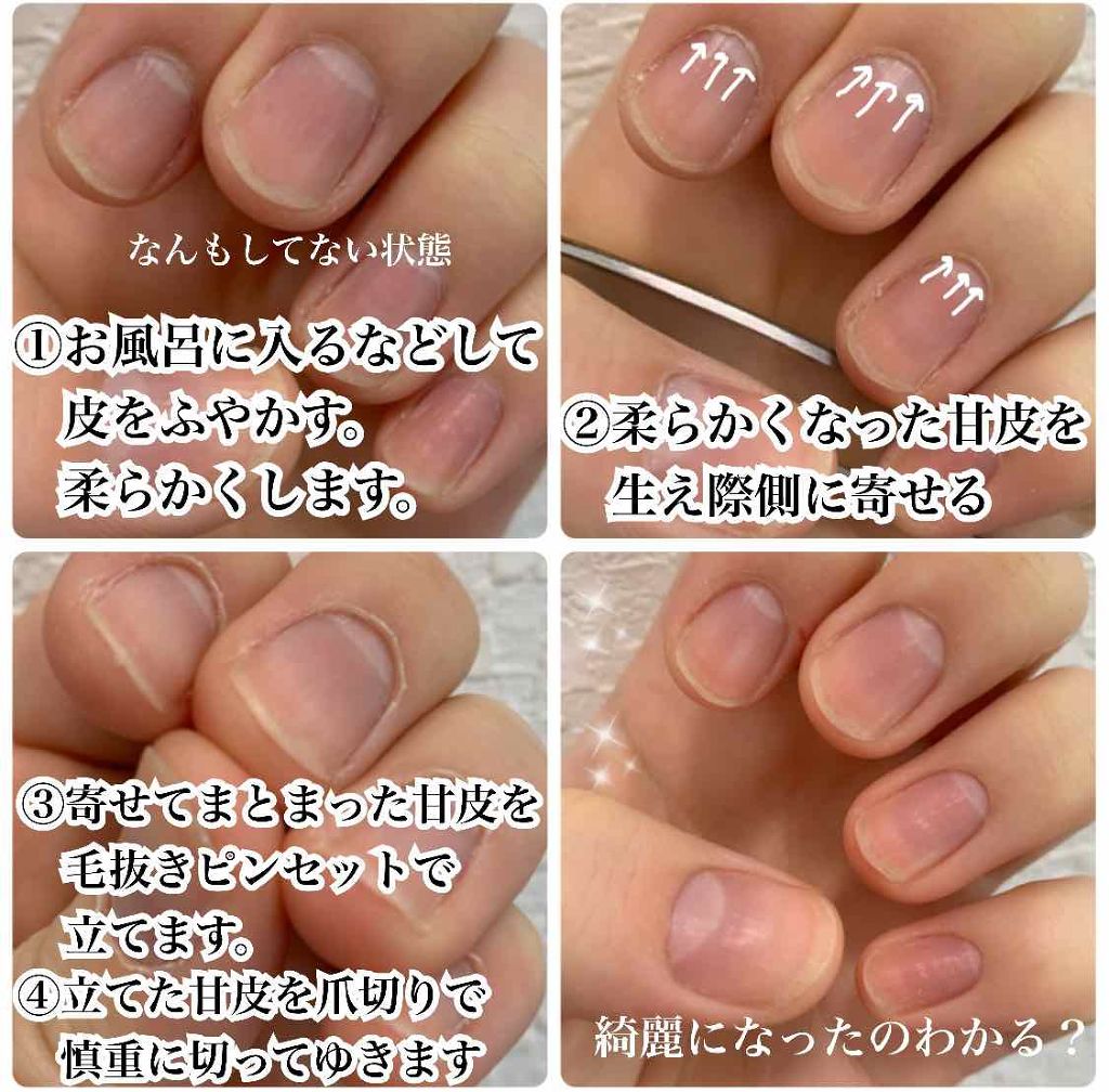 毛抜き/DAISO/毛抜きを使ったクチコミ(2枚目)