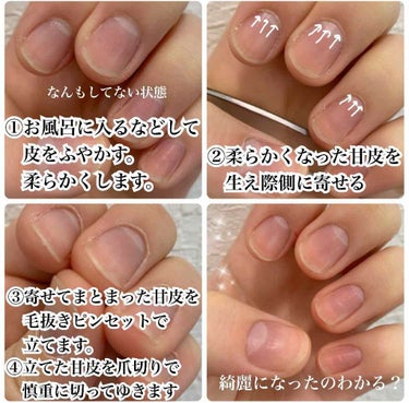 毛抜き Daisoの口コミ 超優秀 100均で買えるおすすめ化粧小物 甘皮ケアみんなどうしてる 自己流セルフのお手入れ紹介 By いつか 正直レビュー 混合肌 30代前半 Lips 毛抜き Daisoの口コミ 超優秀 100均で買えるおすすめ化粧小物 甘皮ケアみんなどうしてる 自己流セルフのお手入れ紹介 By いつか 正直レビュー 混合肌 30代前半 Lips