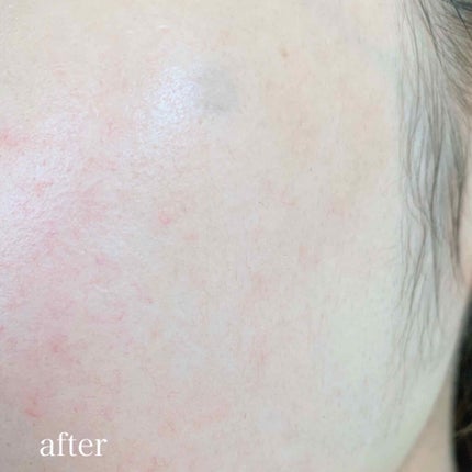 インビジブルピーリングブースターエッセンス/CNP Laboratory/ブースター・導入液を使ったクチコミ(3枚目)