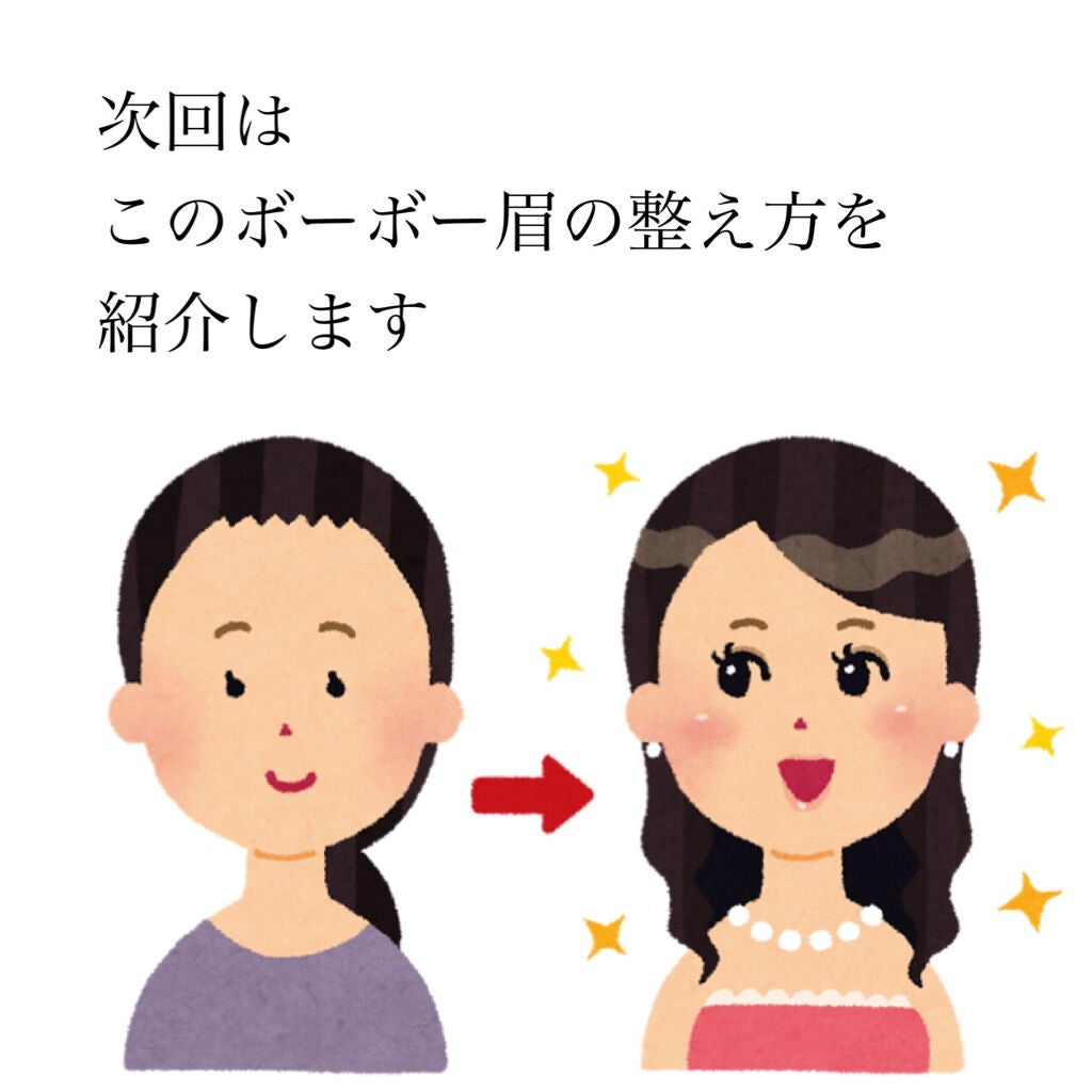 脱色クリーム 敏感肌用/エピラット/ムダ毛ケアを使ったクチコミ(5枚目)