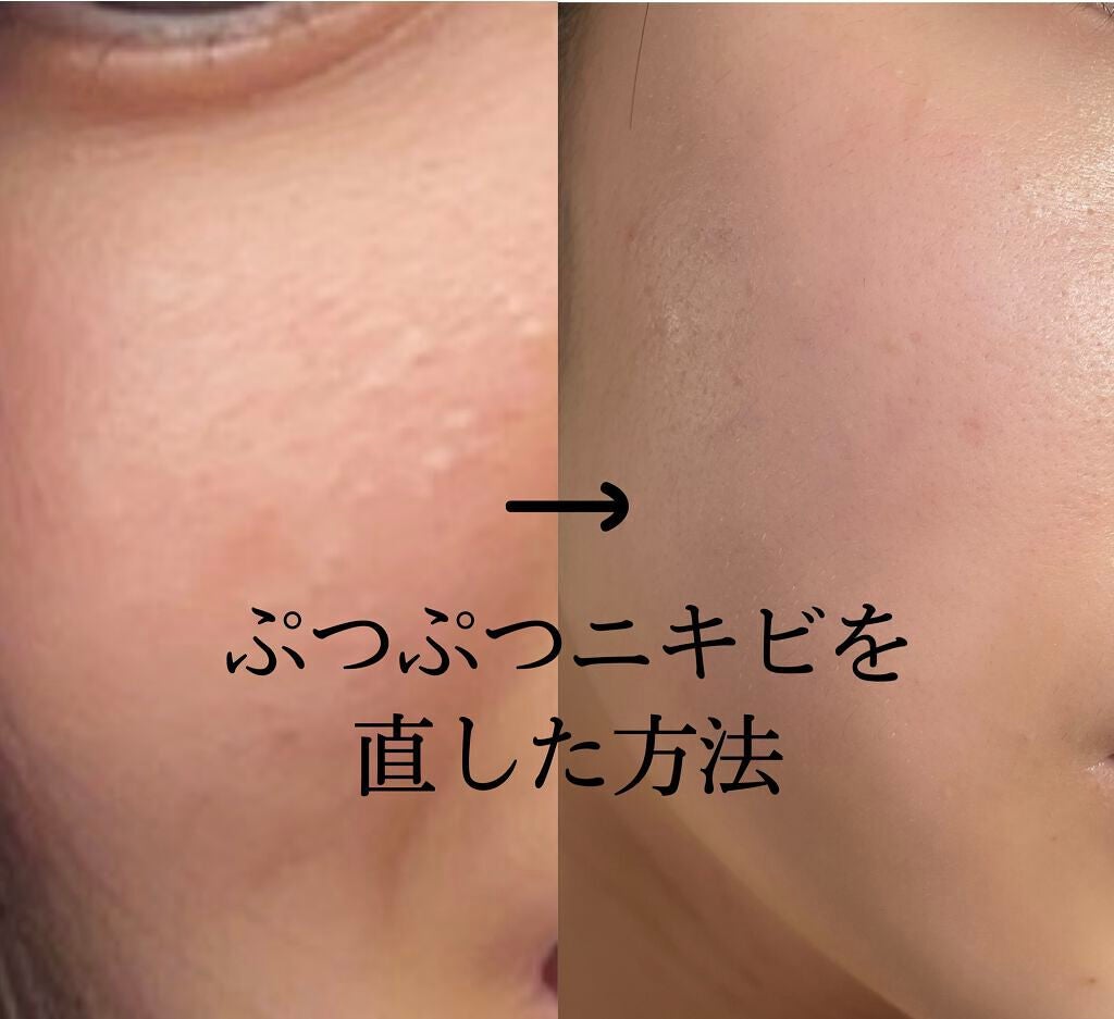 化粧水・敏感肌用・しっとりタイプ/無印良品/化粧水を使ったクチコミ(1枚目)