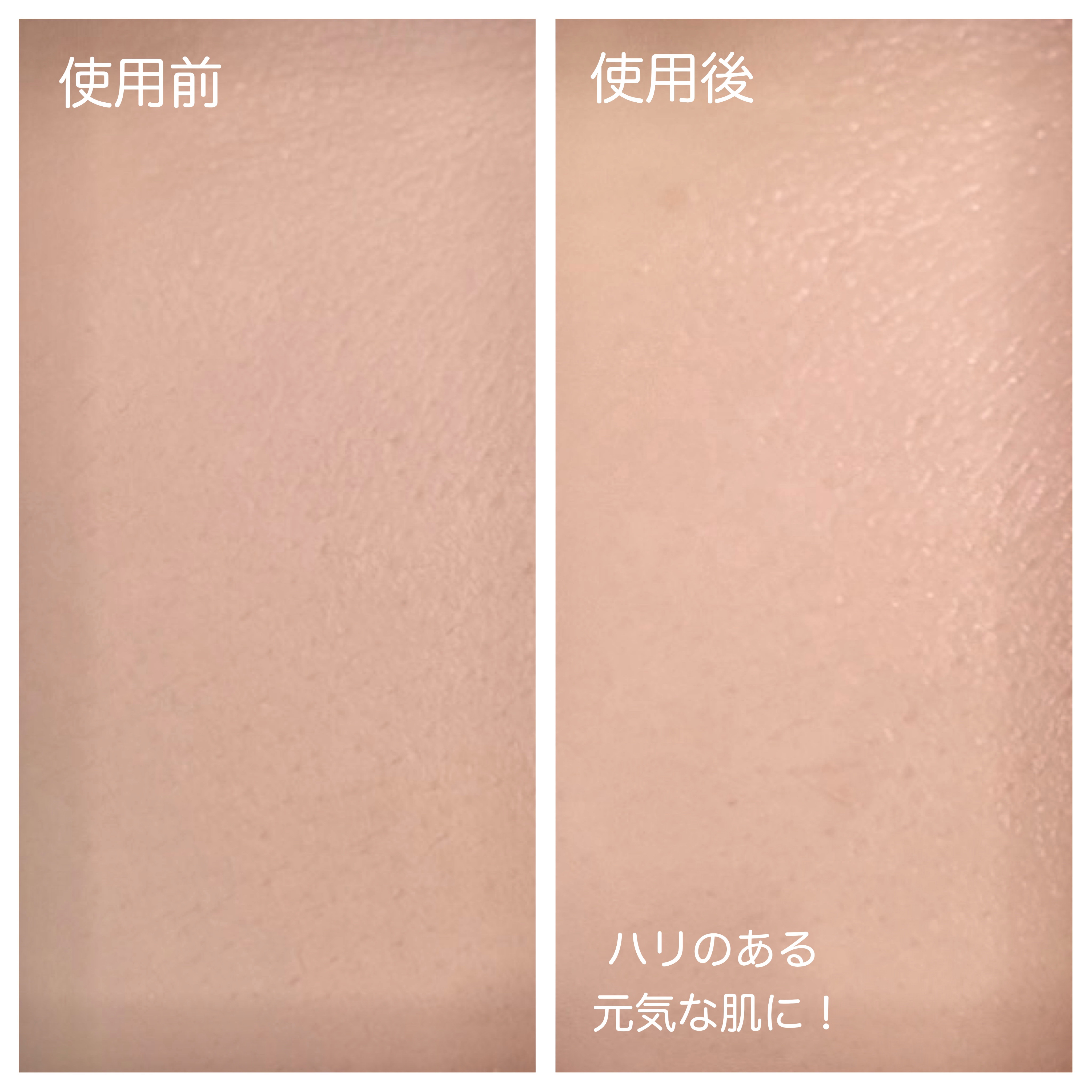 もち肌コラーゲンクリーム/MEDICUBE/フェイスクリームを使ったクチコミ（2枚目）