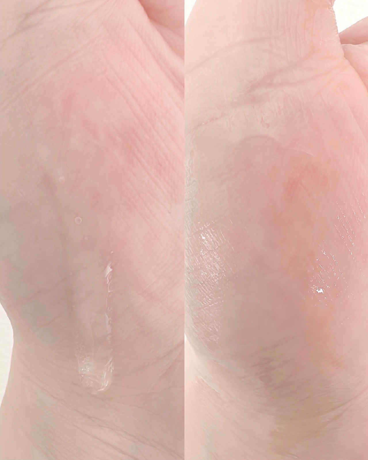 Cemenrete Calcium Intense Ampoule/Dr.Melaxin/美容液を使ったクチコミ（3枚目）