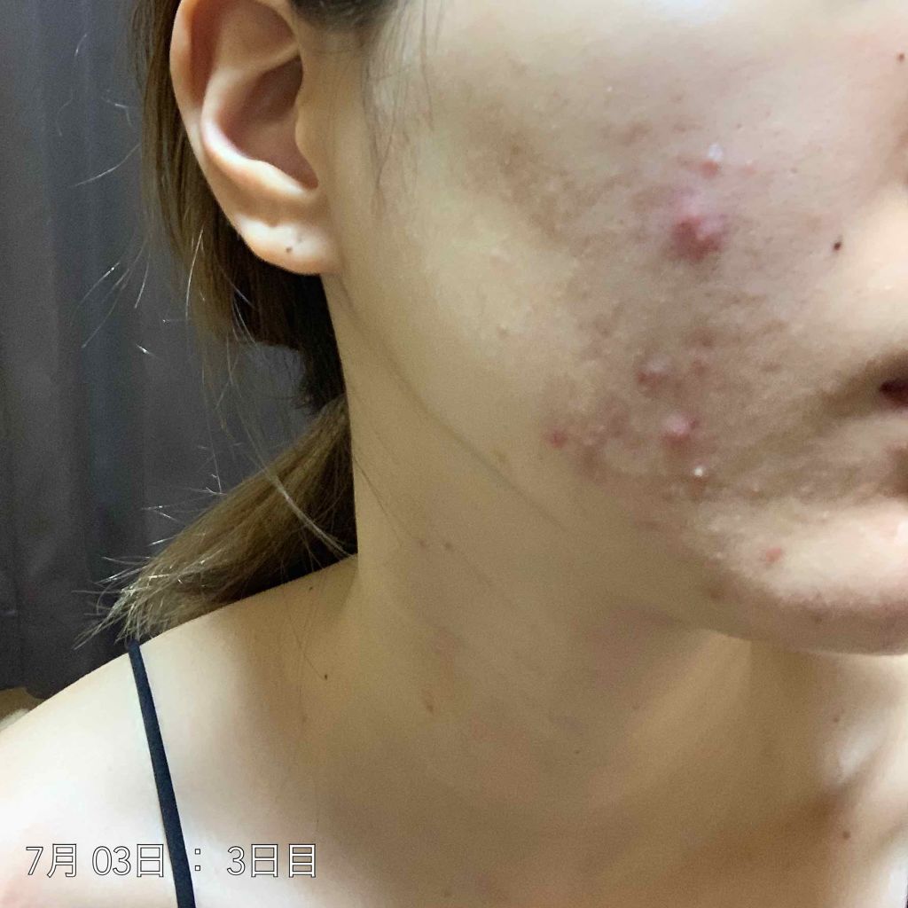 ハトムギ保湿ジェル(ナチュリエ スキンコンディショニングジェル)/ナチュリエ/美容液を使ったクチコミ（3枚目）