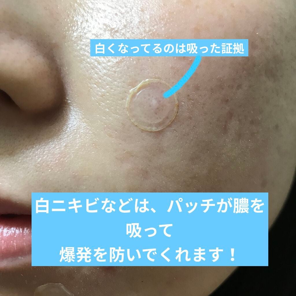 プロCICA クリアスポットパッチ/VT/その他スキンケアを使ったクチコミ(9枚目)