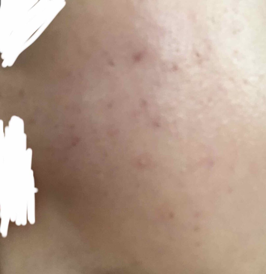 DHC マルチビタミン/DHC/美容サプリメントを使ったクチコミ（2枚目）