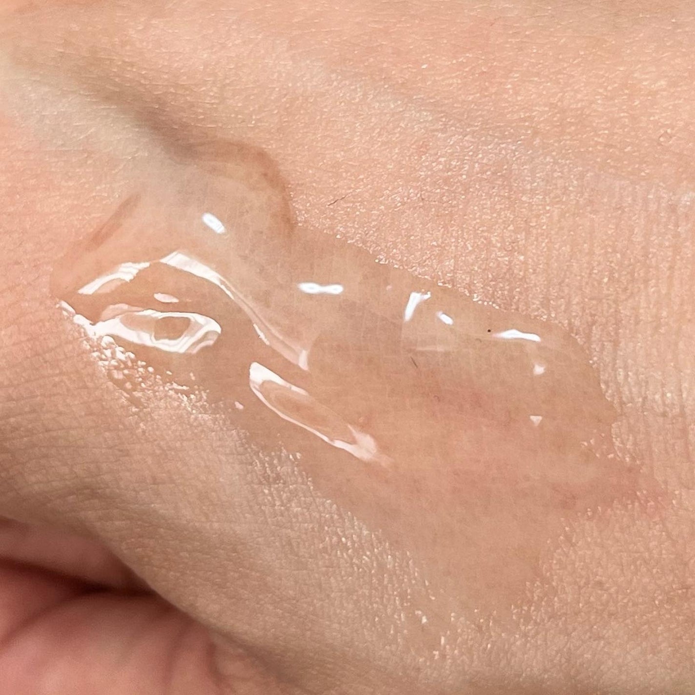 アクニドクターファーストスピーディースポット/ISOI/美容液を使ったクチコミ(5枚目)