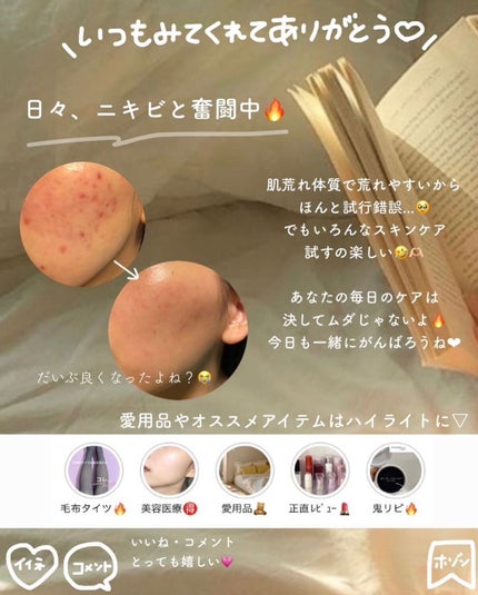 yuyuð¶èèãäœè³ªã®æ£çŽã¬ãã¥ãŒ on LIPS ããèèãäžã®ã¡ã³ã¿ã«ã®ä¿ã¡æ¹ãâŒâ¢â¢âââ¢â¢âŒâ¢â¢âââ¢â¢âŒâ¢..ãïŒ10æç®ïŒ