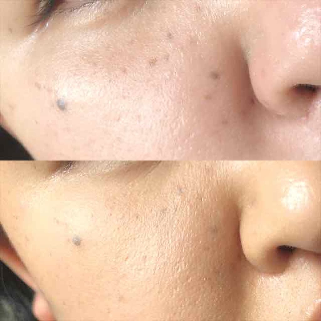 エッセンスBBパクト/CEZANNE/BBクリームを使ったクチコミ（3枚目）