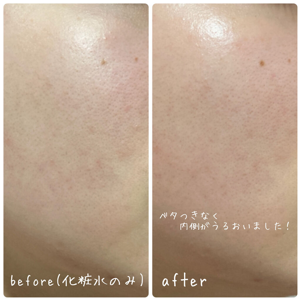 ハイドロデュー PPセラム/HERA/美容液を使ったクチコミ（3枚目）