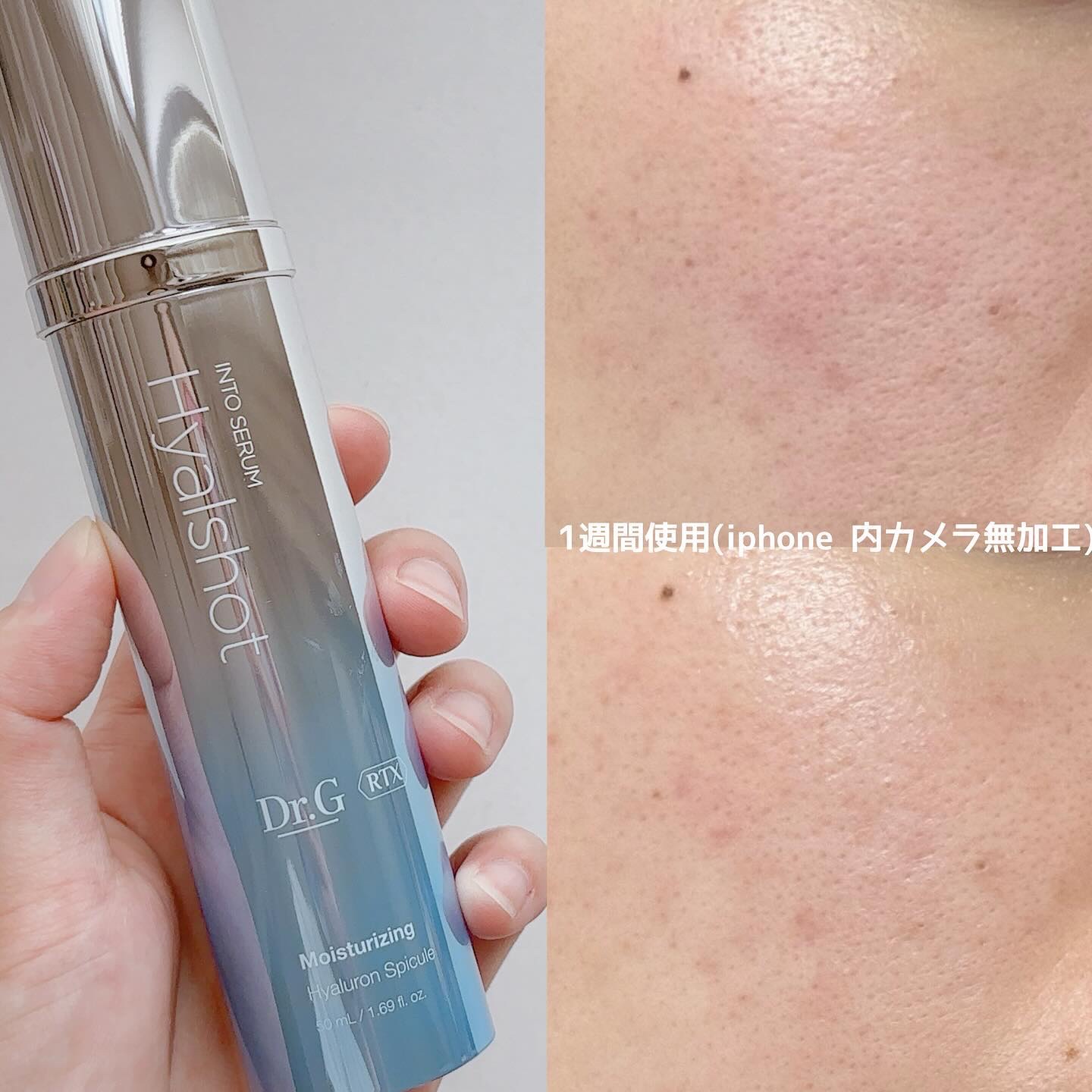 RTXセラム ヒアルショット/Dr.G/美容液を使ったクチコミ（3枚目）