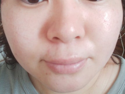 タイムレスリペア 未来肌おためしセット/CELASEEQ/スキンケアキットを使ったクチコミ(6枚目)