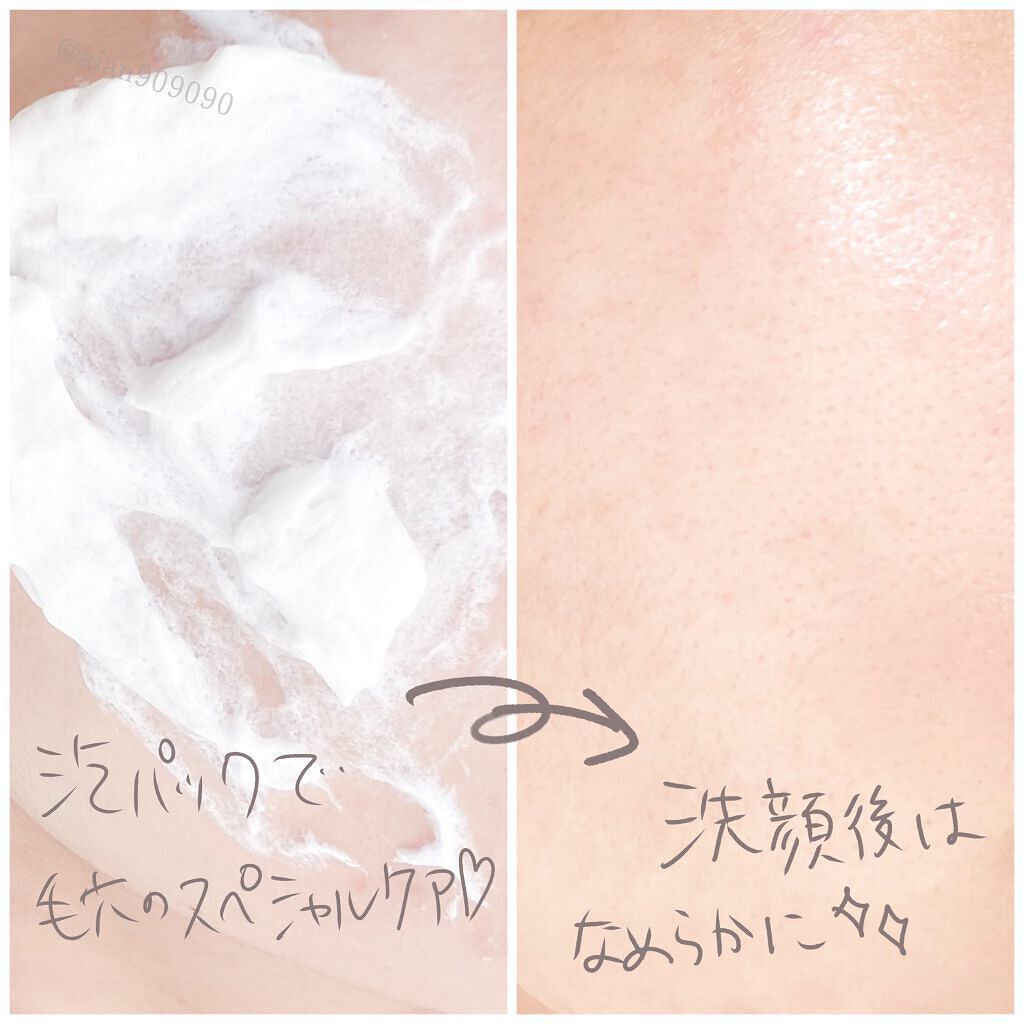 ピールソープ AHA/プラスキレイ/洗顔石鹸を使ったクチコミ(6枚目)