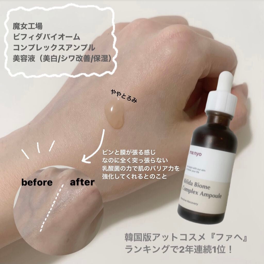 ビフィダバイオームコンプレックスセラム/manyo/美容液を使ったクチコミ(1枚目)