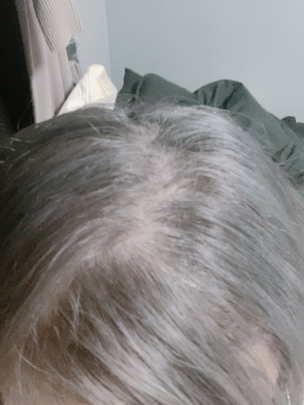 薬用スカルプエッセンス/HAIRICHE/頭皮ローションを使ったクチコミ（3枚目）