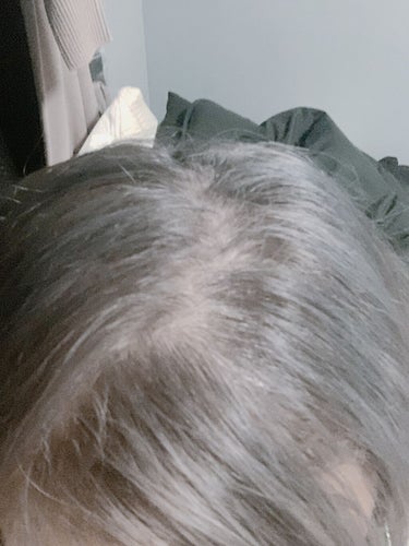 HAIRICHE 薬用スカルプエッセンスのクチコミ「

実は女性と男性の薄毛は全く原因が違うんだそう！

女性の薄毛は、加齢による女性ほるもんの減.....」（3枚目）