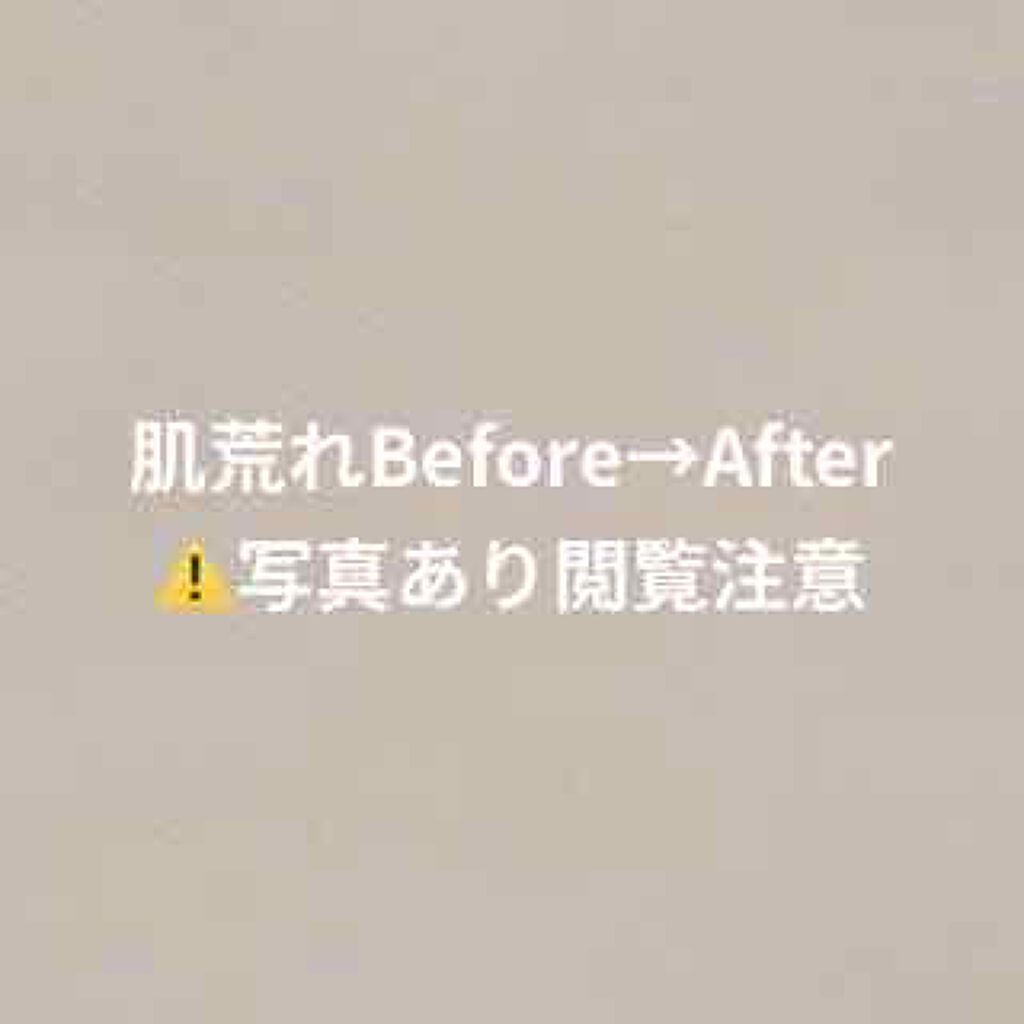 ジョンソン ベビーローション/ジョンソンベビー/ボディローションを使ったクチコミ（1枚目）