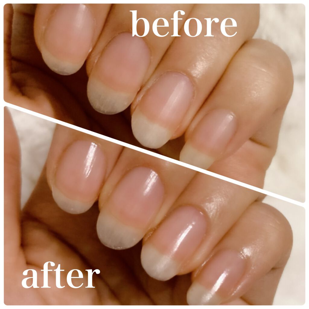 グロウケアコート/デュカート/ネイルオイル・トリートメントを使ったクチコミ(3枚目)