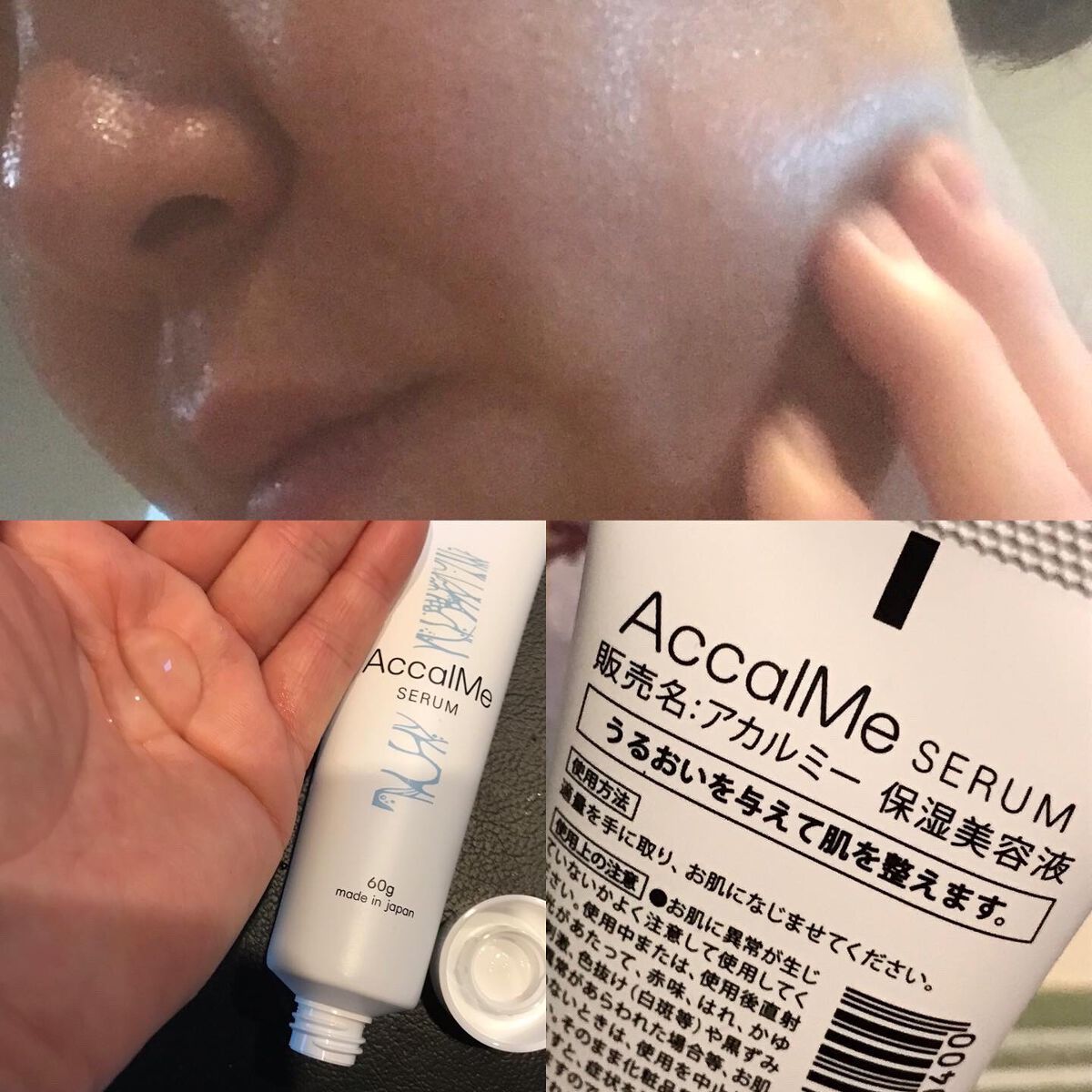 アカルミー セラム/ワイズ製薬/美容液を使ったクチコミ(3枚目)