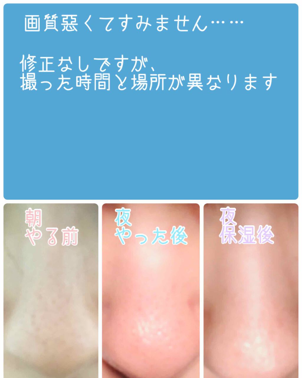 ホホバオイル/無印良品/ボディオイルを使ったクチコミ（2枚目）