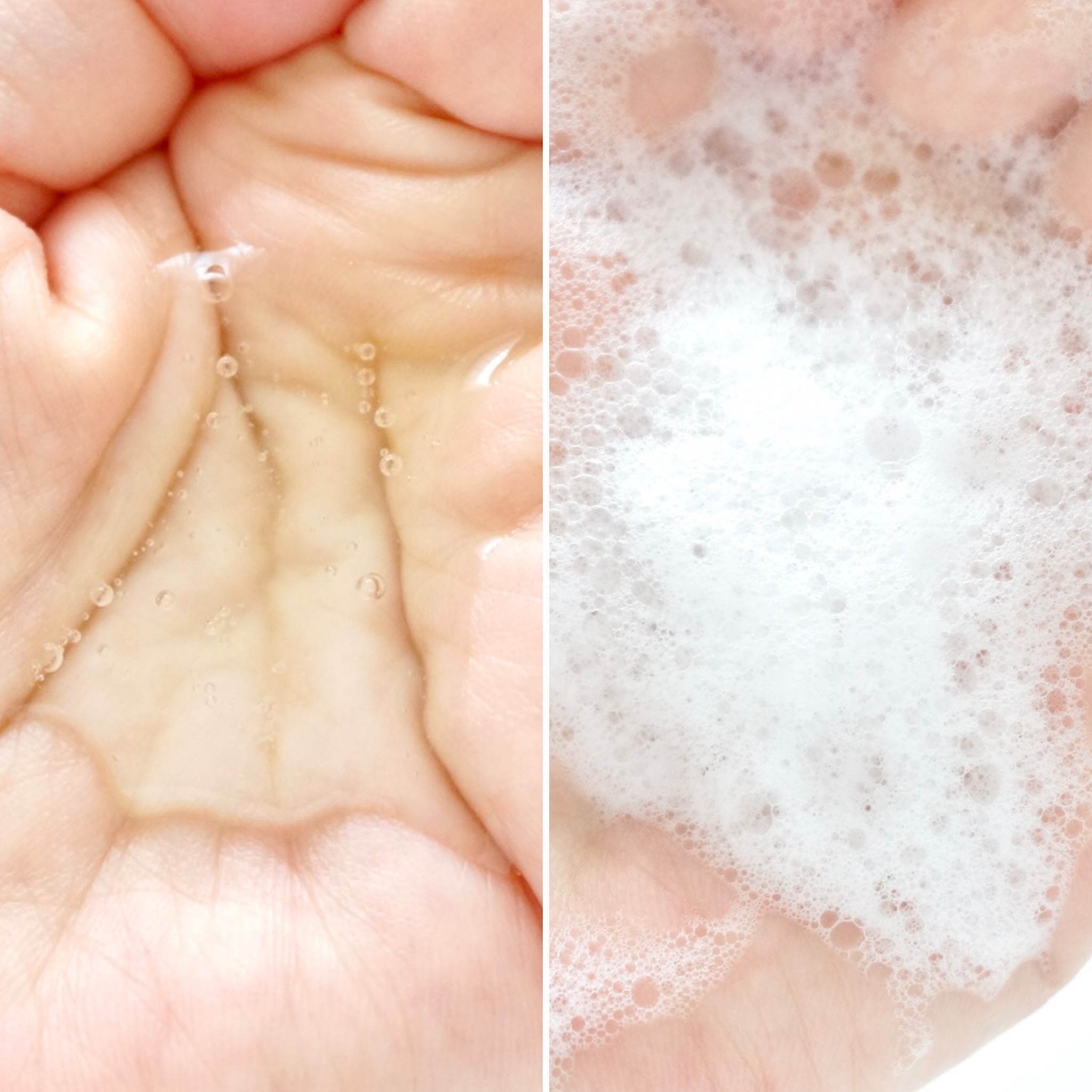 エイドスカルプシャンプー/ビューランチ/市販シャンプーを使ったクチコミ（3枚目）