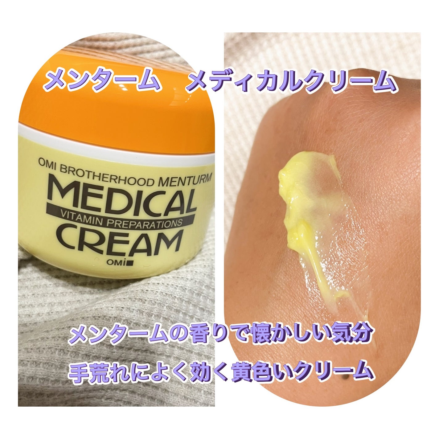 メディカルクリームG(薬用クリームG)/メンターム/ハンドクリームを使ったクチコミ(1枚目)