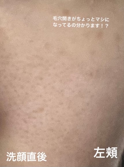 泡洗顔 ブライトアップ/ビフェスタ/泡洗顔を使ったクチコミ(6枚目)