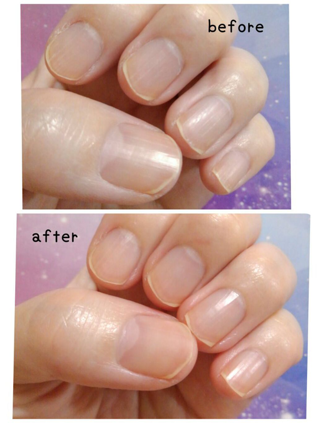 SHジェルネイル(ライト不要)/セリア/ジェルネイルを使ったクチコミ(3枚目)